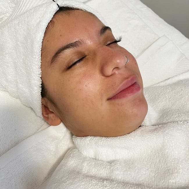 Chemical peel facial